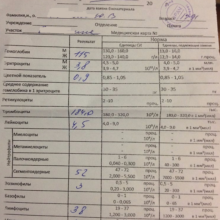 СДР